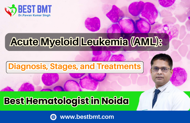 Acute Myeloid Leukemia Treatments